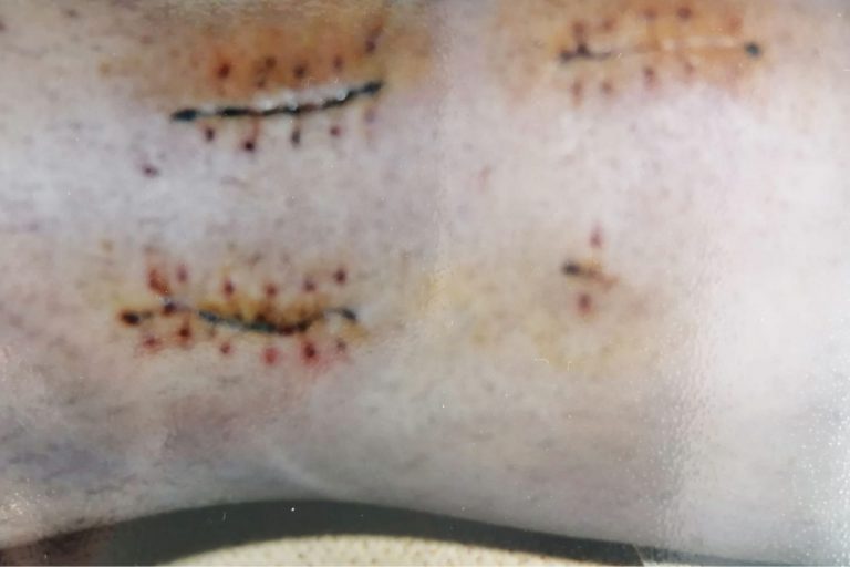 cuando_se_te_rompe_el_mundo_H